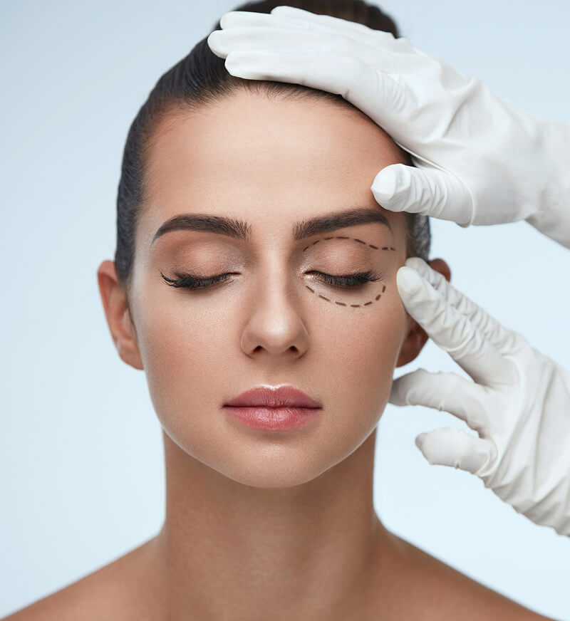 A woman with closed eyes, calm expression, marked with dotted lines under her eyes. Gloved hands gently touch her face, suggesting cosmetic procedure planning.