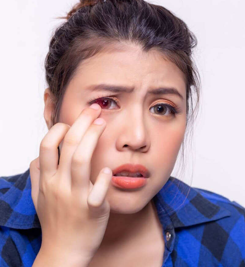 Young woman with a concerned expression touches her right eye, which appears red and irritated. She's wearing a blue plaid shirt, conveying discomfort.