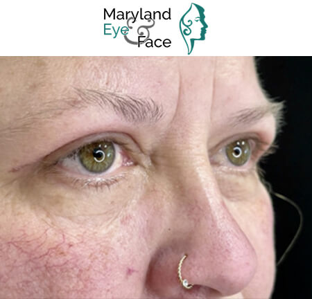 Close-up of a woman's eyes and nose, featuring green eyes and a gold jeweled nose ring, under the Maryland Eye & Face logo.