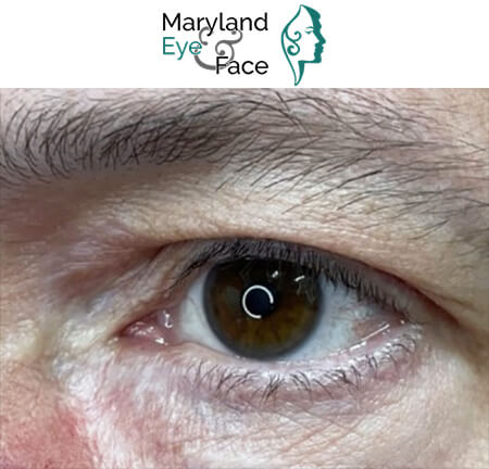 Close-up of a brown human eye showing the iris, eyelashes, and surrounding skin, with the Maryland Eye & Face logo in the upper margin.